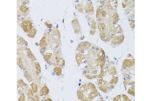 Immunohistochemistry of paraffin-embedded Human stomach using HDAC4 Polyclonal Antibody at dilution of 1:100 (40x lens).