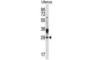 CIB4 Antibody (N-term) western blot analysis in human normal Uterus cell line lysates (35µg/lane). (CIB4 anticorps  (N-Term))