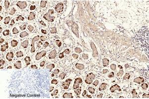 Immunohistochemical analysis of paraffin-embedded human stomach tissue. (NF-kB p65 anticorps  (acLys310))