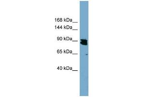 WB Suggested Anti-KIAA0317 Antibody Titration:  0. (AREL1 anticorps  (N-Term))
