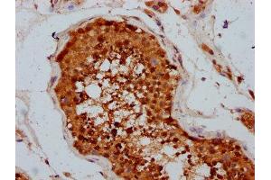 IHC image of ABIN7173536 diluted at 1:400 and staining in paraffin-embedded human testis tissue performed on a Leica BondTM system. (TSEN15 anticorps  (AA 1-171))