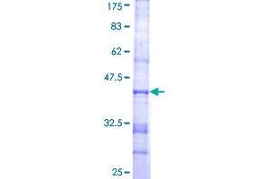 SDS-PAGE (SDS) image for ST3 beta-Galactoside alpha-2,3-Sialyltransferase 6 (ST3GAL6) (AA 145-240) protein (GST tag) (ABIN1790188)