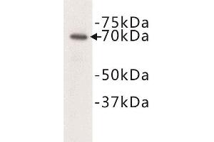Western Blotting (WB) image for anti-Complement C3 beta Chain (C3b) antibody (ABIN1854871) (Complement C3b anticorps)