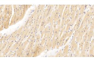 Detection of GATA4 in Human Cardiac Muscle Tissue using Polyclonal Antibody to GATA Binding Protein 4 (GATA4) (GATA4 anticorps  (AA 201-442))