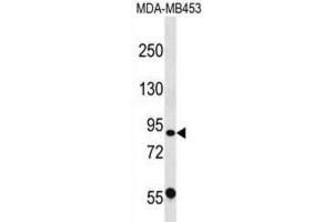 Western Blotting (WB) image for anti-Calpain 13 (CAPN13) antibody (ABIN2998758) (CAPN13 anticorps)