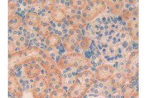 DAB staining on IHC-P; Samples: Rat Kidney Tissue (TGFB1I1 anticorps  (AA 256-461))