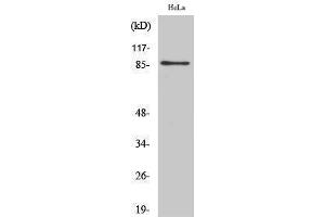 Western Blotting (WB) image for anti-UTP14, U3 Small Nucleolar Ribonucleoprotein, Homolog A (UTP14A) (Internal Region) antibody (ABIN3187442) (UTP14A anticorps  (Internal Region))