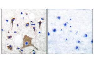 Immunohistochemistry (IHC) image for anti-Glutamate Receptor, Ionotropic, Kainate 1 (GRIK1) (N-Term) antibody (ABIN1848574) (GRIK1 anticorps  (N-Term))
