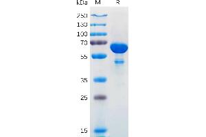 Human L1 Protein, hFc Tag on SDS-PAGE under reducing condition.