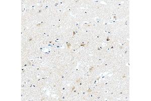 anti-Abl-Interactor 2 (ABI2) (AA 151-400) antibody