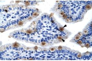 Immunohistochemical staining (Formalin-fixed paraffin-embedded sections) of human lung with MCM6 polyclonal antibody . (MCM6 anticorps  (AA 771-820))