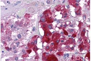 Human Adrenal: Formalin-Fixed, Paraffin-Embedded (FFPE)