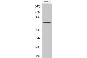 Western Blotting (WB) image for anti-LIM Domain Kinase 2 (LIMK2) (Internal Region) antibody (ABIN3175847) (LIMK2 anticorps  (Internal Region))
