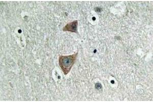 Immunohistochemistry (IHC) analyzes of p70 S6 kinase alpha antibody in paraffin-embedded human brain tissue. (RPS6KB1 anticorps)