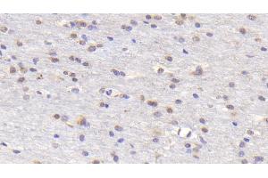 Detection of RANk in Human Cerebrum Tissue using Polyclonal Antibody to Receptor Activator Of Nuclear Factor Kappa B (RANk)