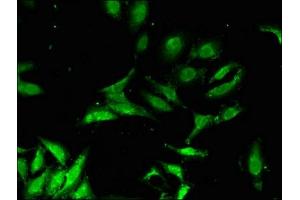 Immunofluorescent analysis of Hela cells using ABIN7146261 at dilution of 1:100 and Alexa Fluor 488-congugated AffiniPure Goat Anti-Rabbit IgG(H+L)