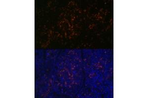 Immunofluorescence analysis of mouse spleen using BTK Rabbit mAb (ABIN7265950) at dilution of 1:100 (40x lens). (BTK anticorps)