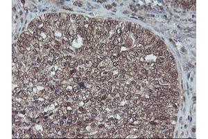 Image no. 12 for anti-Haloacid Dehalogenase-Like Hydrolase Domain Containing 1 (HDHD1) antibody (ABIN1498623) (HDHD1 anticorps)