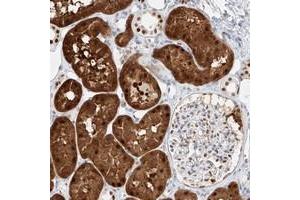 Immunohistochemical staining of human kidney with APIP polyclonal antibody  shows cytoplasmic and nuclear positivity in tubular cells. (APIP anticorps)
