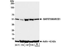 Western Blotting (WB) image for anti-SWI/SNF Related, Matrix Associated, Actin Dependent Regulator of Chromatin, Subfamily E, Member 1 (SMARCE1) (C-Term) antibody (ABIN7795730)