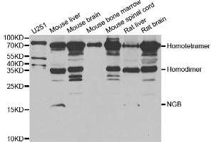 Western blot analysis of extracts of various cell lines, using NGB antibody.
