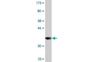Western Blot detection against Immunogen (36. (COG3 anticorps  (AA 25-124))