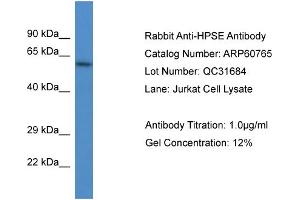 Western Blotting (WB) image for anti-Heparanase (HPSE) (N-Term) antibody (ABIN2788567) (HPSE anticorps  (N-Term))