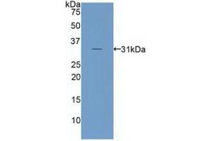 Detection of Recombinant LRP6, Human using Polyclonal Antibody to Low Density Lipoprotein Receptor Related Protein 6 (LRP6) (LRP6 anticorps  (AA 981-1213))