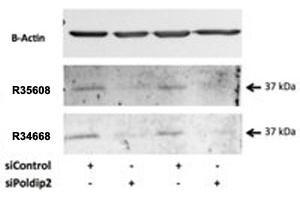 Western blot testing of rat VSMC lysate with POLDIP2 antibody at 0. (POLDIP2 anticorps)