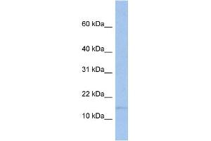WB Suggested Anti-TRAPPC2 Antibody Titration:  0. (TRAPPC2 anticorps  (Middle Region))