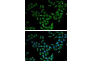 Immunofluorescence analysis of HeLa cell using ASF1A antibody. (ASF1A anticorps)