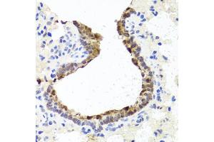 Immunohistochemistry of paraffin-embedded rat lung using TOPBP1 antibody (ABIN6134114, ABIN6149397, ABIN6149400 and ABIN6216254) at dilution of 1:100 (40x lens). (TOPBP1 anticorps  (AA 1-100))