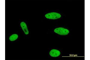 Immunofluorescence of monoclonal antibody to MLLT1 on HeLa cell. (MLLT1 anticorps  (AA 472-559))