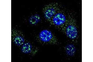 Confocal immunofluorescent analysis of MGMT antibody with MCF-7 cells followed by Alexa Fluor 488-conjugated goat anti-rabbit lgG (green).