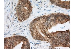 Immunohistochemical staining of paraffin-embedded Human liver tissue using anti-ACAT2 mouse monoclonal antibody. (ACAT2 anticorps)