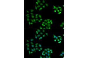 Immunofluorescence analysis of HeLa cells using NSFL1C antibody (ABIN6131003, ABIN6144873, ABIN6144874 and ABIN6222382).