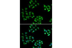 Immunofluorescence analysis of HeLa cells using NSFL1C antibody (ABIN6131003, ABIN6144873, ABIN6144874 and ABIN6222382). (NSFL1C anticorps  (AA 1-185))