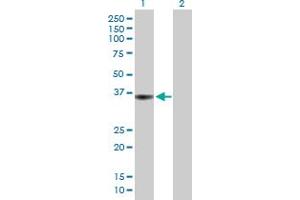 Western Blot analysis of PTPRF expression in transfected 293T cell line by PTPRF MaxPab polyclonal antibody.