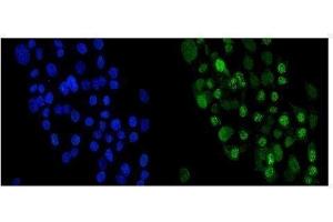 IF analysis of Periplakin using anti-Periplakin antibody (ABIN5518787). (PPL anticorps  (C-Term))