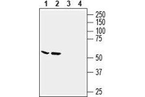 Western blot analysis of human MCF-7 breast adenocarcinoma cell line (lanes 1 and 3) and human LNCaP prostate adenocarcinoma cell line (lanes 2 and 4) lysates: - 1,2. (Slc6a14 anticorps  (2nd Extracellular Loop))