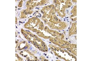 Immunohistochemistry of paraffin-embedded human kidney using WBSCR22 antibody (ABIN4905616) at dilution of 1:100 (40x lens). (WBSCR22 anticorps)
