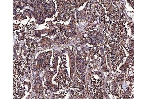 IHC analysis of CD147/Emmprin using anti-CD147/Emmprin antibody (ABIN7599998).