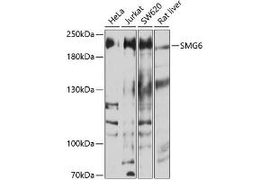 Western blot analysis of extracts of various cell lines, using SMG6 antibody (ABIN6133311, ABIN6148132, ABIN6148133 and ABIN6214288) at 1:1000 dilution. (SMG6 anticorps  (AA 1160-1419))