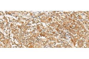 Immunohistochemistry of paraffin-embedded Human tonsil tissue using JPT1 Polyclonal Antibody at dilution of 1:35(x200) (JPT1 anticorps)