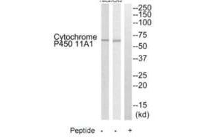 Western blot analysis of extracts from HeLa cells and A549 cells, using Cytochrome P450 11A1 antibody. (CYP11A1 anticorps  (C-Term))