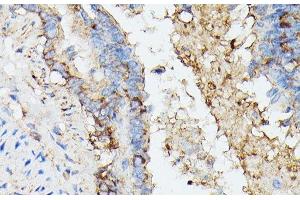 Immunohistochemistry of paraffin-embedded Rat lung using KRT14 Polyclonal Antibody at dilution of 1:100 (40x lens).