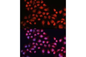 Immunofluorescence analysis of A-431 using Cortactin antibody (ABIN6127722, ABIN6139243, ABIN6139244 and ABIN6221478) at dilution of 1:25 (40x lens).