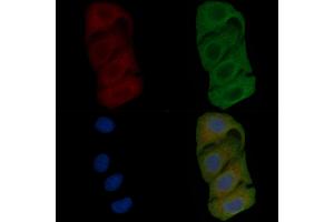 ABIN6257851 and ABIN6275627 staining Hela cells(45 min of heat-shock) by IF/ICC. (TSSK4 anticorps  (Internal Region))