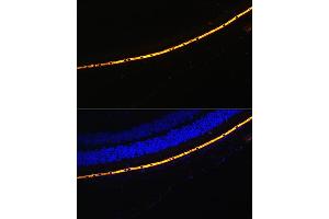 Immunofluorescence analysis of Mouse eye cells using RPE65 antibody (ABIN6130679, ABIN6147090, ABIN6147091 and ABIN6225161) at dilution of 1:100. (RPE65 anticorps  (AA 274-533))