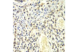 Immunohistochemistry of paraffin-embedded human colon using PSMA4 antibody (ABIN6291447) at dilution of 1:100 (40x lens). (PSMA4 anticorps)